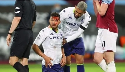 تريزيجيه يتلقي 6 غرز في الرأس بعد مباراة استون فيلا ووست هام